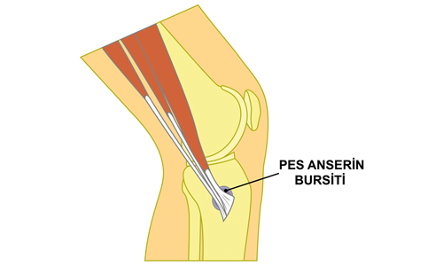 Pes Anserin Bursiti Nedir? Tanı ve Tedavisi